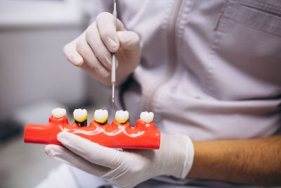 Prefeitura oferece implantes dentários para toda população 